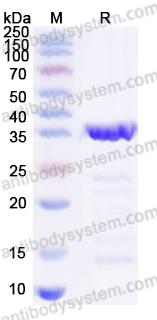 Валидация AntibodySystem YXX08503