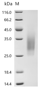 SDS-PAGE