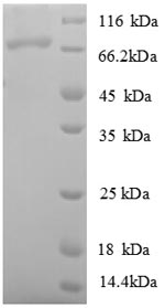 SDS-PAGE
