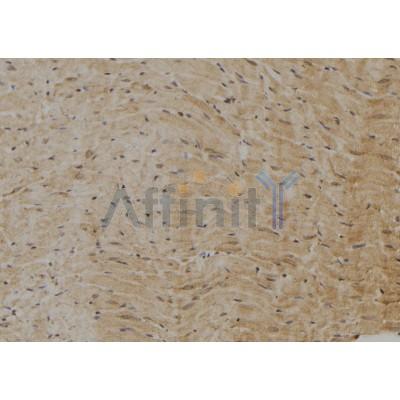 Валидация Affinity DF6978 - 18607