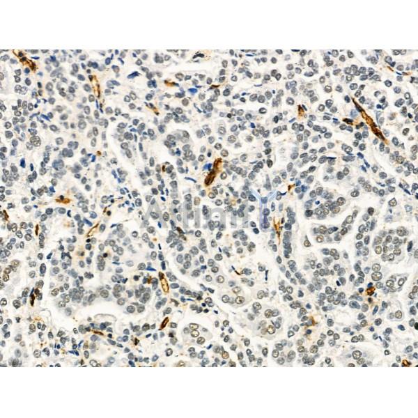 Валидация Affinity DF6370 - 17721