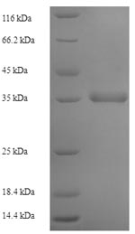 SDS-PAGE