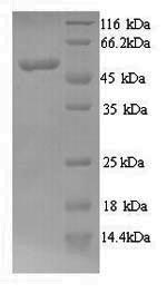 SDS-PAGE