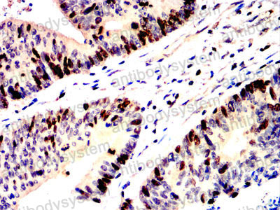 Валидация AntibodySystem RHB22803 (291)