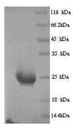 SDS-PAGE