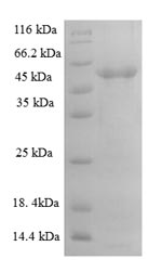 SDS-PAGE