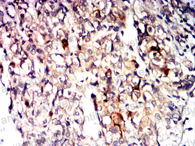 Валидация AntibodySystem RHC33012 (888)