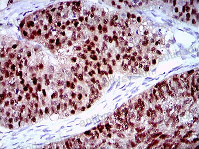 Валидация AntibodySystem RHN08502 (3798)