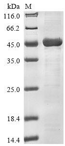 SDS-PAGE