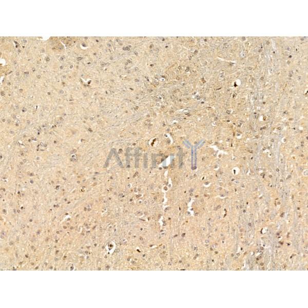 Валидация Affinity DF13582 - 9054