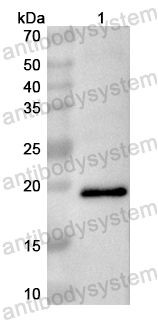 Валидация AntibodySystem PHB38101