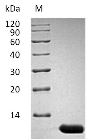 SDS-PAGE