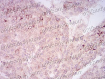 Валидация AntibodySystem RHJ65802