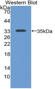 55925