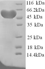 SDS-PAGE