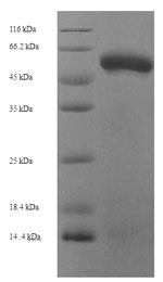 SDS-PAGE