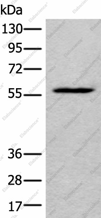 Вестерн-блоттинг, LDHD, клетки HEPG2