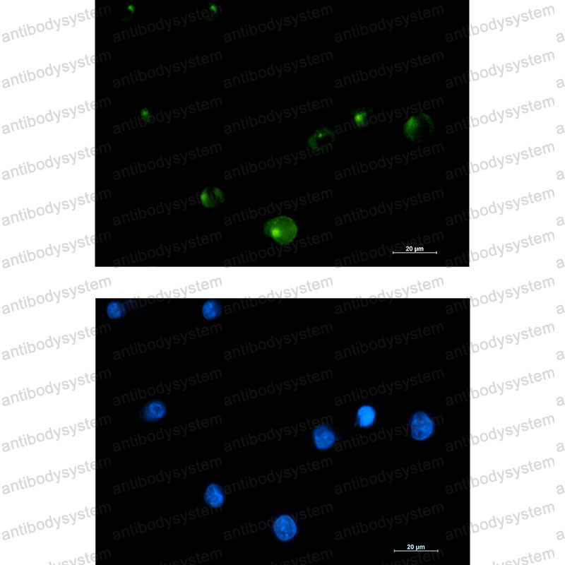 Валидация IF - AntibodySystem RHB71701