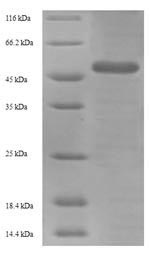 SDS-PAGE