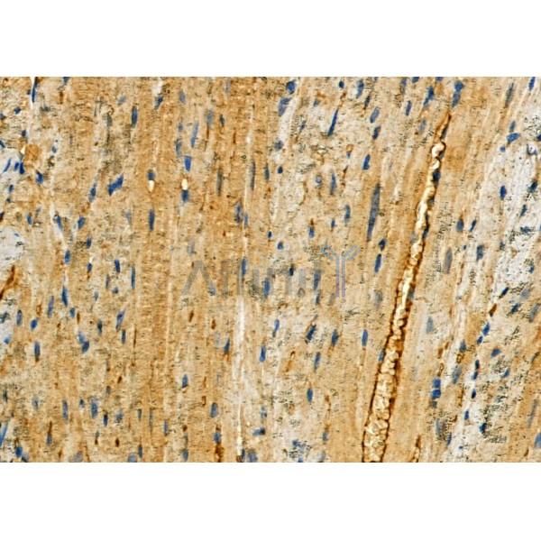 Валидация Affinity DF6763 - 18328