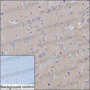 Валидация AntibodySystem RHD25704