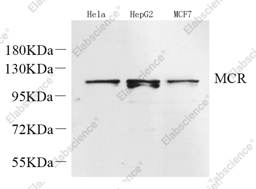 Вестерн-блоттинг, Mineralocorticoid receptor, различные образцы
