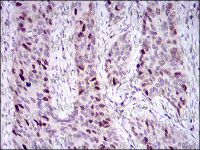 Валидация AntibodySystem RHJ36801 (3390)