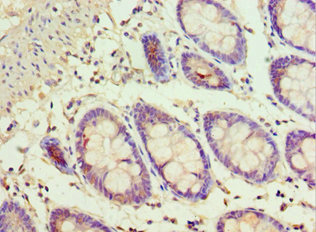 Валидация AssayVector ARM1611(1695)