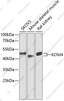 Вестерн-блоттинг, KCNJ4, различные клеточные линии
