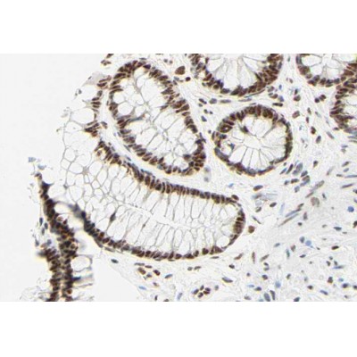 Валидация Affinity AF6020 - 3213