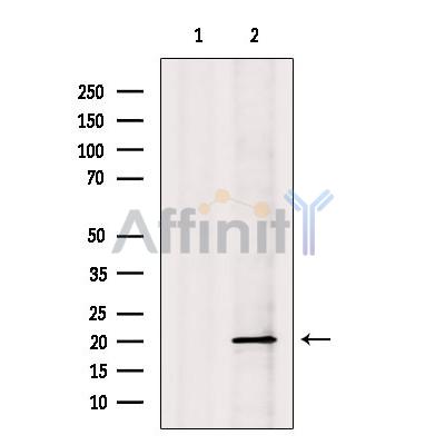 Валидация Affinity DF12301 - 6674