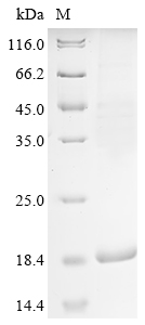 SDS-PAGE