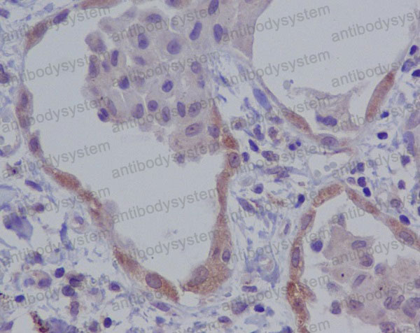 Валидация AntibodySystem RHJ41103