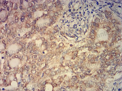 Валидация AntibodySystem RHN42601 (3818)