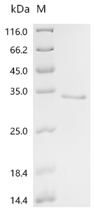 SDS-PAGE