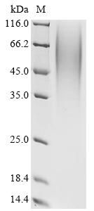 SDS-PAGE