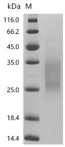 SDS-PAGE