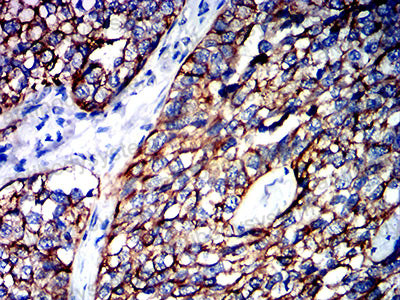 Валидация AntibodySystem RHD31601 (1476)