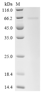 SDS-PAGE