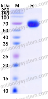 EHK06902, SDS-PAGE