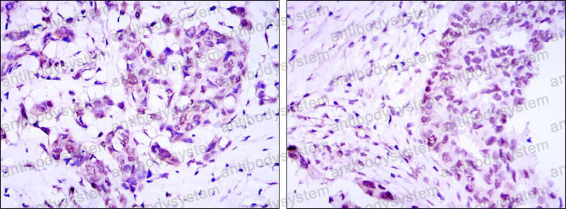 Валидация AntibodySystem RHJ08102 (3331)