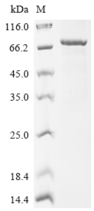 SDS-PAGE
