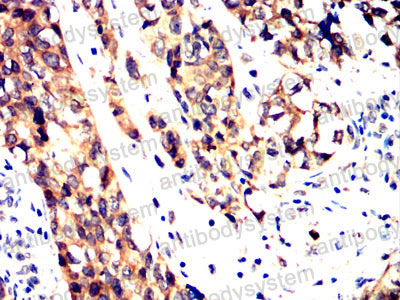 Валидация AntibodySystem RHG17701 (2880)