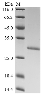 SDS-PAGE