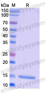 Валидация SDS-PAGE - AntibodySystem RHF39901