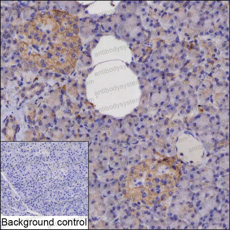 Валидация AntibodySystem RHD08001