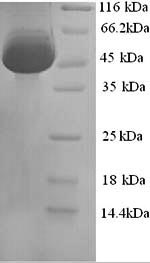 SDS-PAGE