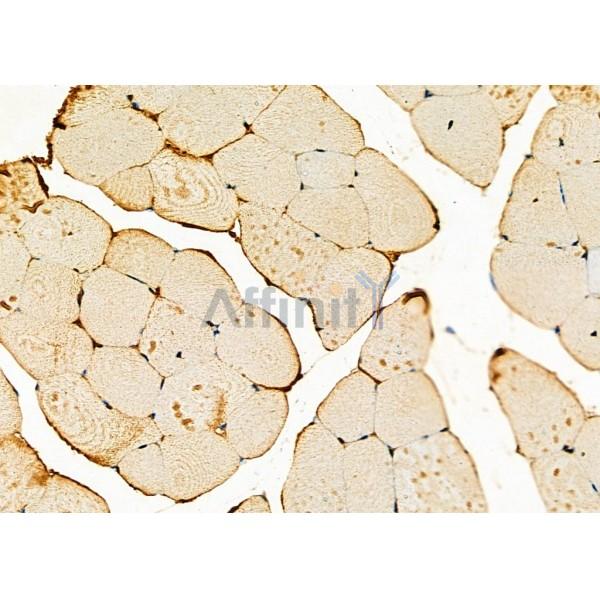 Валидация Affinity DF2757 - 13491