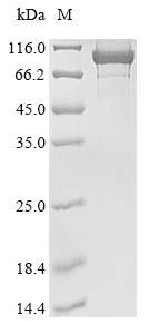 SDS-PAGE