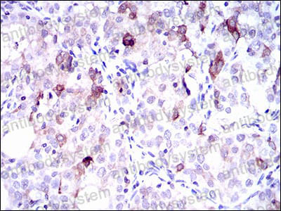 Валидация AntibodySystem RHN99801